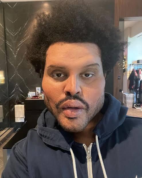 The Weeknd; The Plastic Surgery Disaster Pre- Superbowl Halftime Performance?